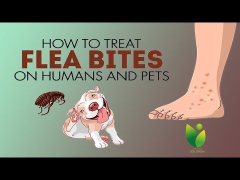 How to Treat Flea Bites on Humans and Pets ~ Home Remedies For Flea Bites on Humans/Dogs Treatment !