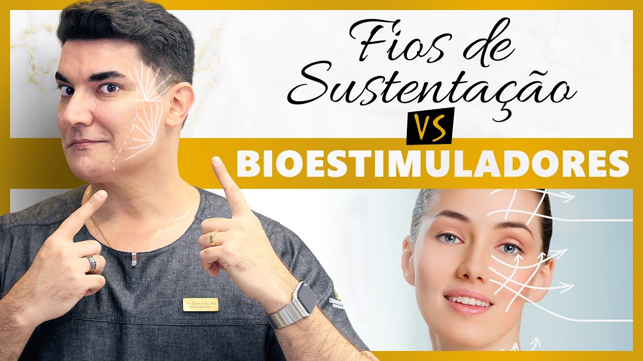 Fios de Sustentação VS Bioestimuladores