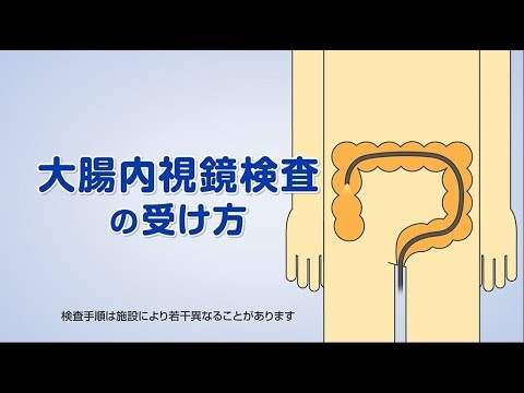 結腸内視鏡検査について詳しく解説