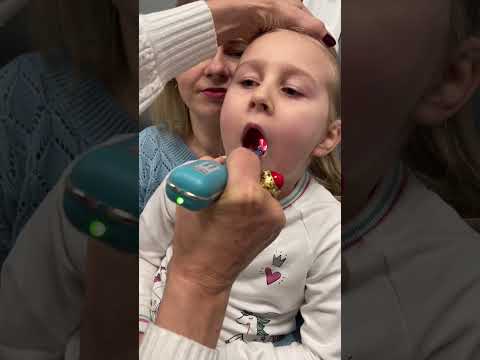 How to examine the third tonsil in children. #third tonsil#camera examination#third tonsil hypert...