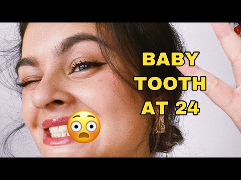 I am a whole adult with a baby tooth | Dental Implant Surgery