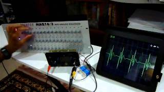 Video thumbnail for ARP Educational Keyboard vs Doepfer MAQ 16/3 sequencer by DJjondent