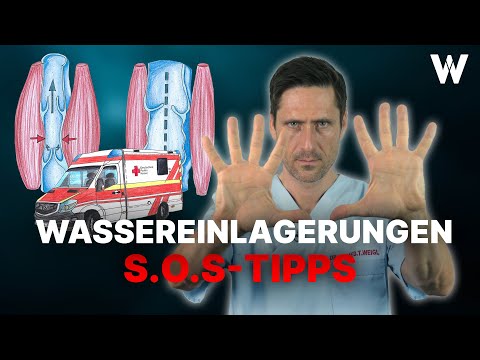 Wassereinlagerungen in Händen & Füßen: Ursachen und Tipps bei angeschwollenen Armen & Beinen (Ödeme)