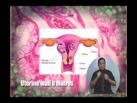 Kung paano kumuha alisan ng cellulite sa 11 taon Roller ilalim slimming baywang diameter