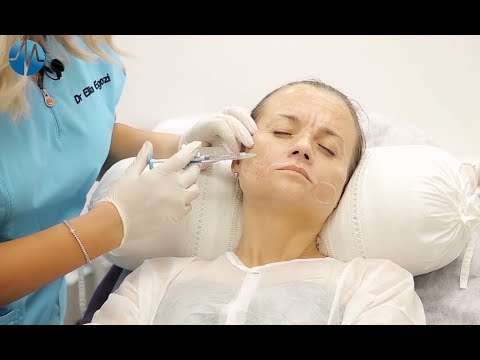 טיפול בפיגמנטציה וקמטים : ד