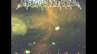 Haemorrhage - I&#39;m a Pathologist