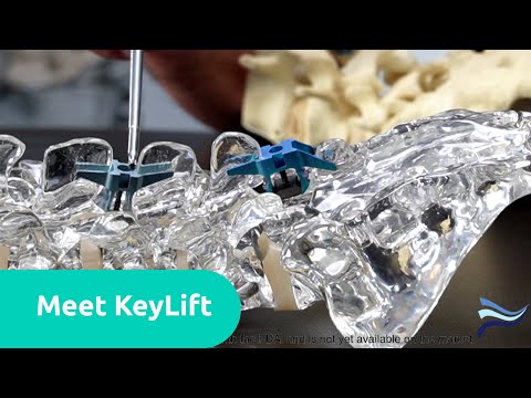 Meet KeyLift* an Expandable Interlaminar Spine Fusion System - FloSpine Innovation Highlight