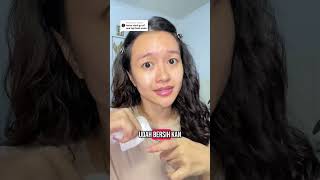 Download lagu Beauty clinic treatment but at home, high frequency facial treatment #highfrequency mp3