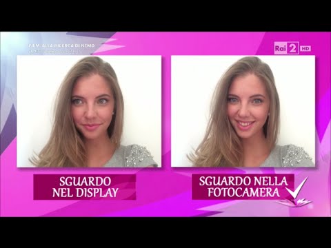Capelli scuri e pelle leggera di una lentiggine Skatka da posti di pigmentary