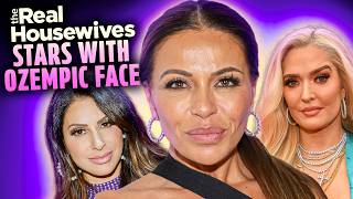 Side-By-Side Pics Of Real Housewives Stars Who Have Sparked 'Ozempic Face' Rumors