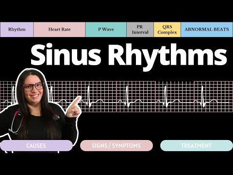 Sinus Rhythm on an EKG with Practice Qs | Circulatory System and Disease | NCLEX-RN | Nurse Cheung
