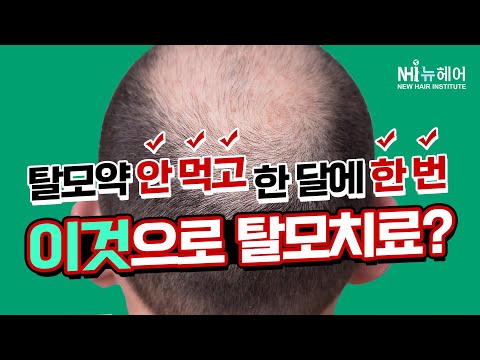 탈모약 안 먹고 OO로 탈모치료? - 뉴헤어 I 탈모치료