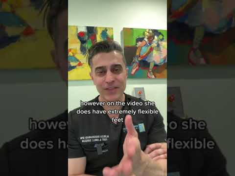 Doctor's Response to Flexible Feet & Bullying Will Leave You Speechless!