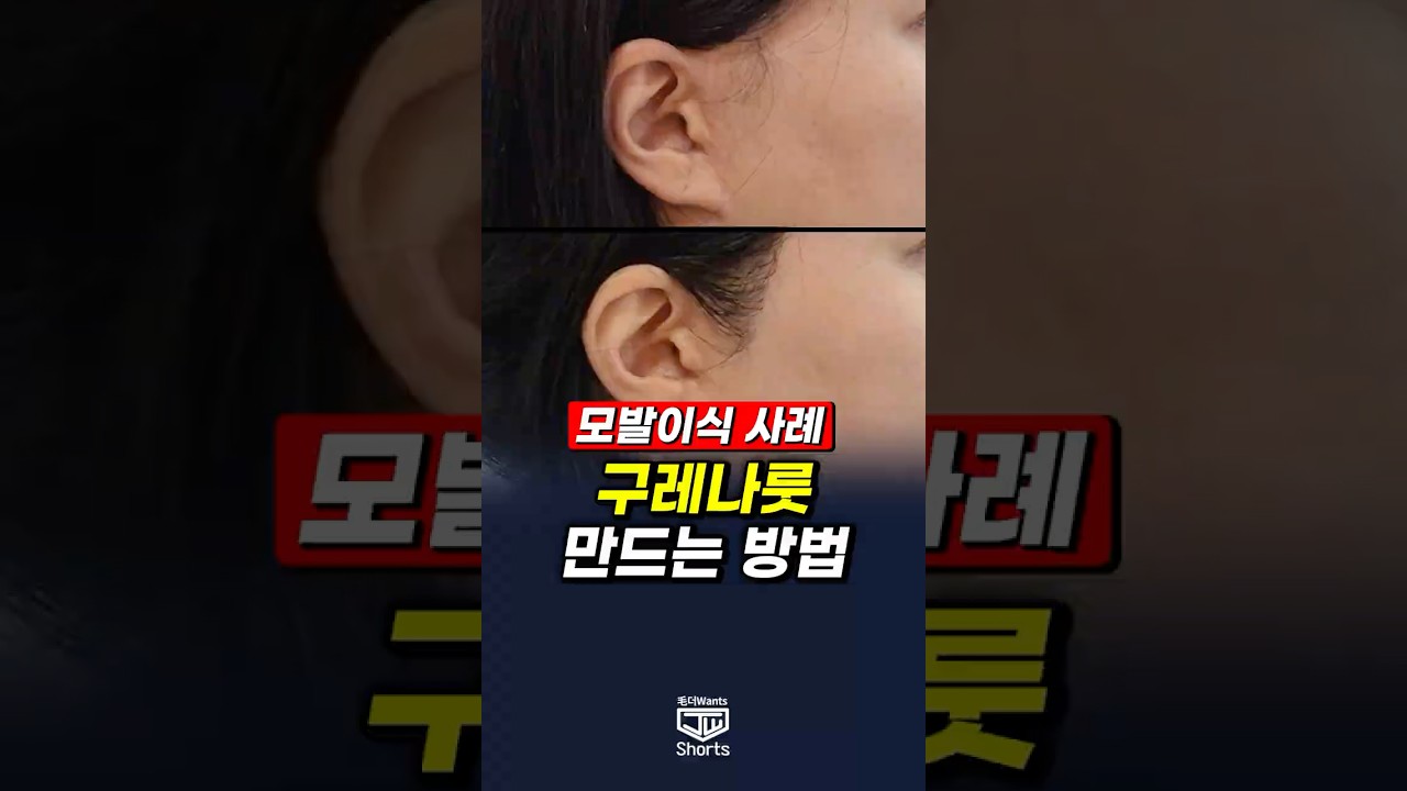 더원츠의원 숏폼
