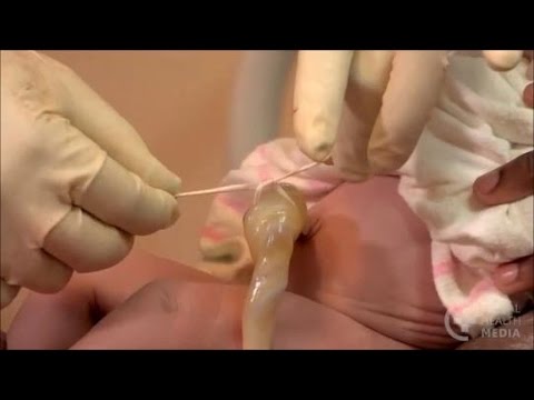 Care of the Cord - Newborn Care Series - YouTube