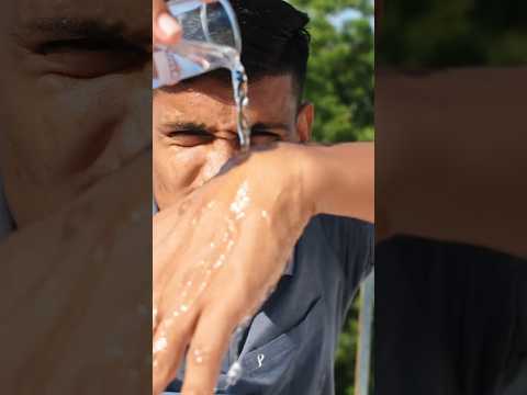 Sulphuric acid V/S human cloth ⚠️ #shorts #discoveryhacker