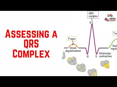How to Read and Interpret an ECG