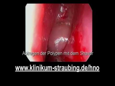 Kiefergelenkbeweglichkeit Schmerzen im unteren Rücken beim Bewegen