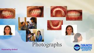 Proper Orthodontic Records for Accurate Braces Planning