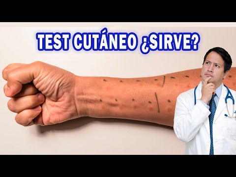 Skin test explained by a doctor, step by step