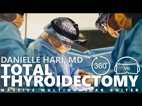 Total Thyroidectomy (Massive Multinodular Goiter) by Dr. Danielle M. Hari