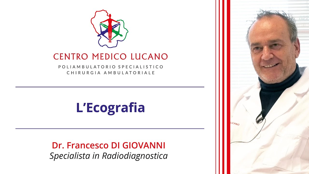 Francesco Di Giovanni-6