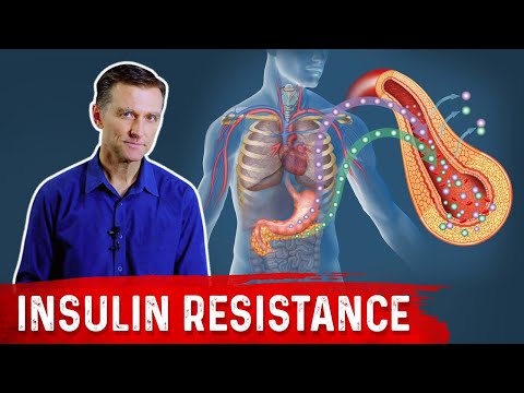 28 Insulin Resistance Symptoms – Dr.Berg