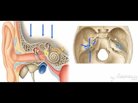 Middle ear site