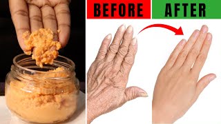 Best Remedy for Dry Wrinkled Hands and feet | whitening home remedies