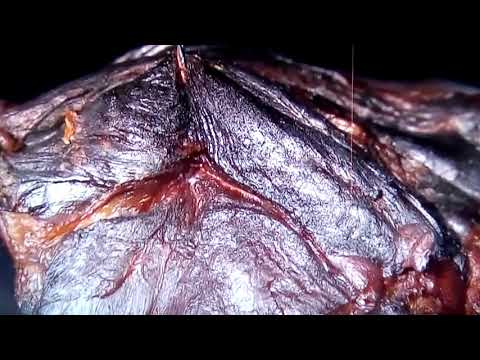 Unumgängliches Urheberrecht? - Der Parmaschinken