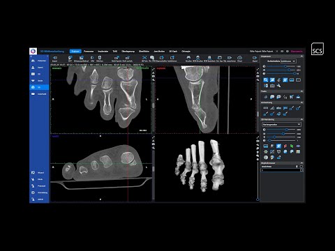 SCS | Society | Dr. med. Dirk Pajonk | Fall 2 | Luxation vs. Fraktur