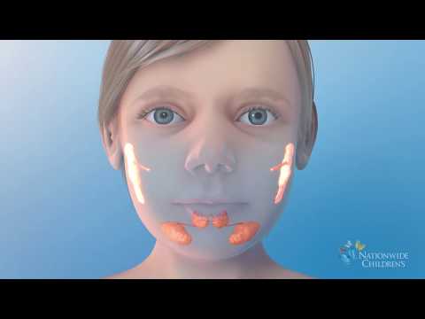 Salivary Gland Ablation | Treatment for Ranulas or Sialorrhea (excessive drooling)