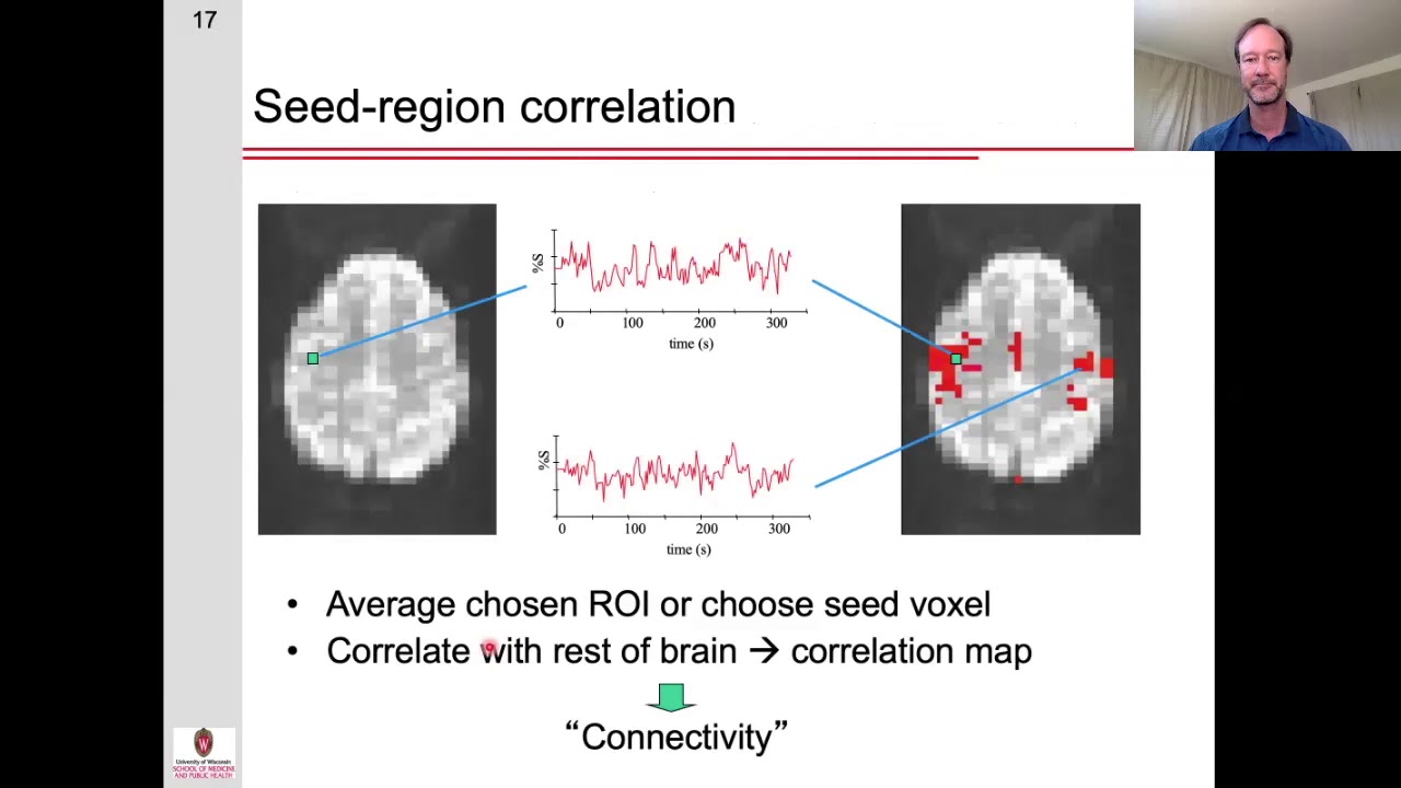 Resting State Functional Connectivity: Part 1 - Introduction