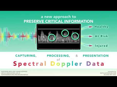 The Sound of the Spine: Spectral Doppler Flow
