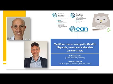 Multifocal motor neuropathy MMN diagnosis, treatment and update on biomarkers