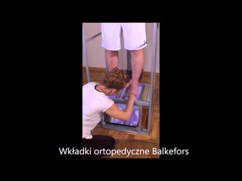 Niż leczyć narośla na stawach palców Problem z kością palucha