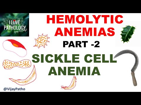 Hemolytic Anemias- Part 2: SICKLE CELL ANEMIA- Pathology