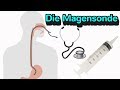 Everything You Need To Know About The Nasogastric Tube