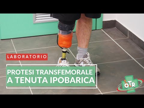 OTR Ortopedia - LABORATORIO - Ottobock_Protesi Transfemorale a Tenuta Ipobarica