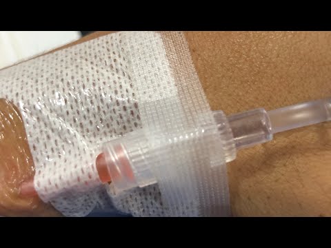 ❤️‍🩹 Me operaron de esto y kumi me cuida.