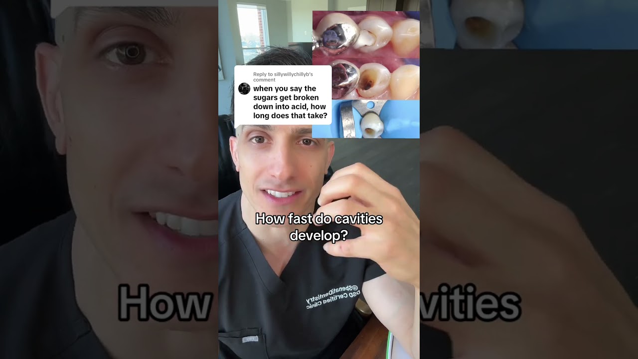How fast do cavities develop