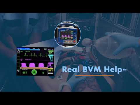 X Series Advanced - Sizzle Video