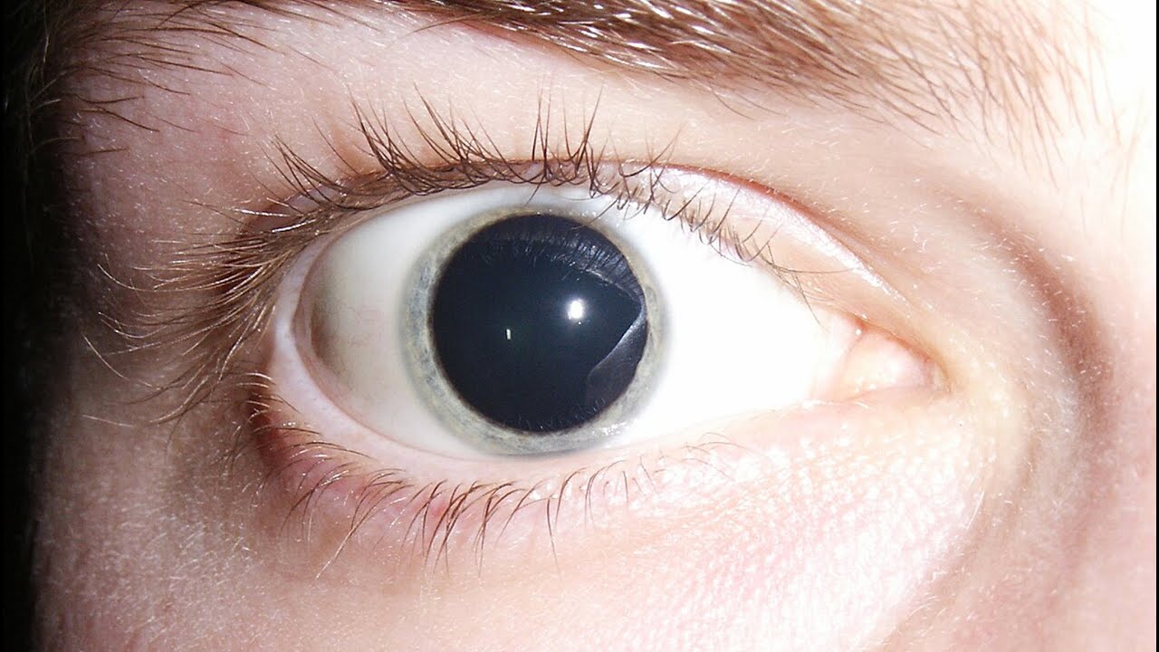 Ya tienes distimia y no lo sabes