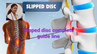 Slipped disc herniation complete guide line||कमर दर्द के कारण बचाव या उपाय#trending #youtube #physio