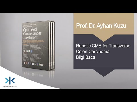 3.1.7. Robotic CME for Transverse Colon Carcinoma - Bilgi Baca