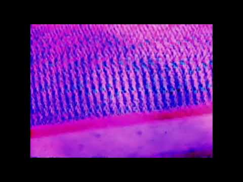 The Imbeciles -- Stalking Boy