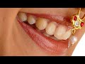 Tapsee Pannu Beautiful Lips Closeup Tapsee Pannu