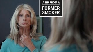 CDC: Tips From Former Smokers - Terrie H.’s Tip Ad