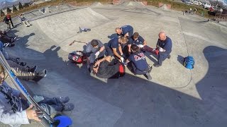 DAD BREAKS HIS LEG IN TWO PLACES AT SKATE PARK WITH FOUR KIDS