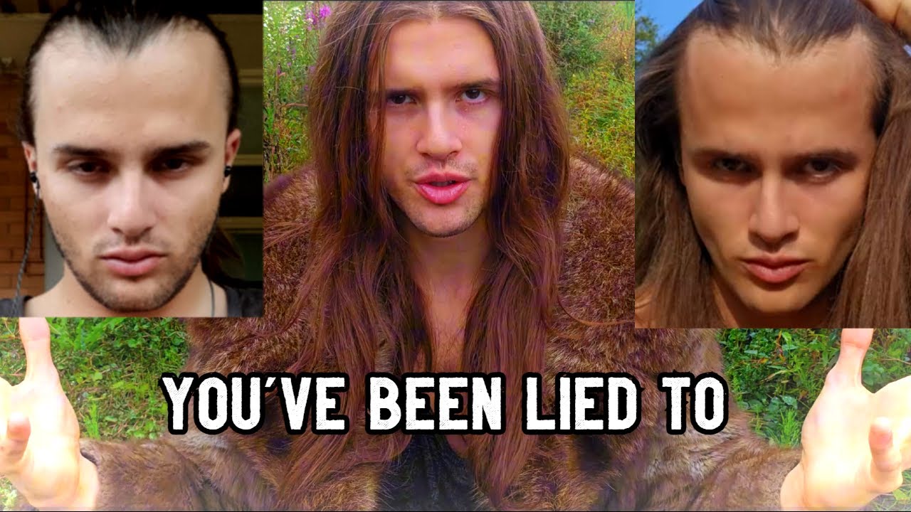 The raw truth about reversing hair loss naturally...